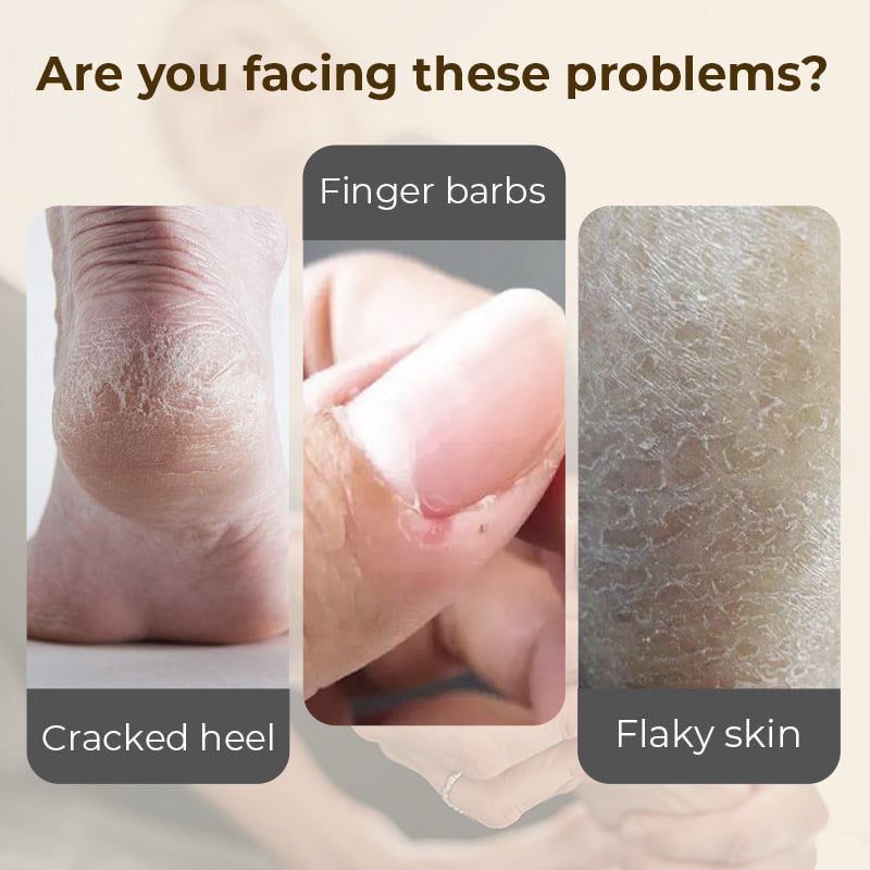 🧴Hydrating and Anti-Cracking Foot Cream